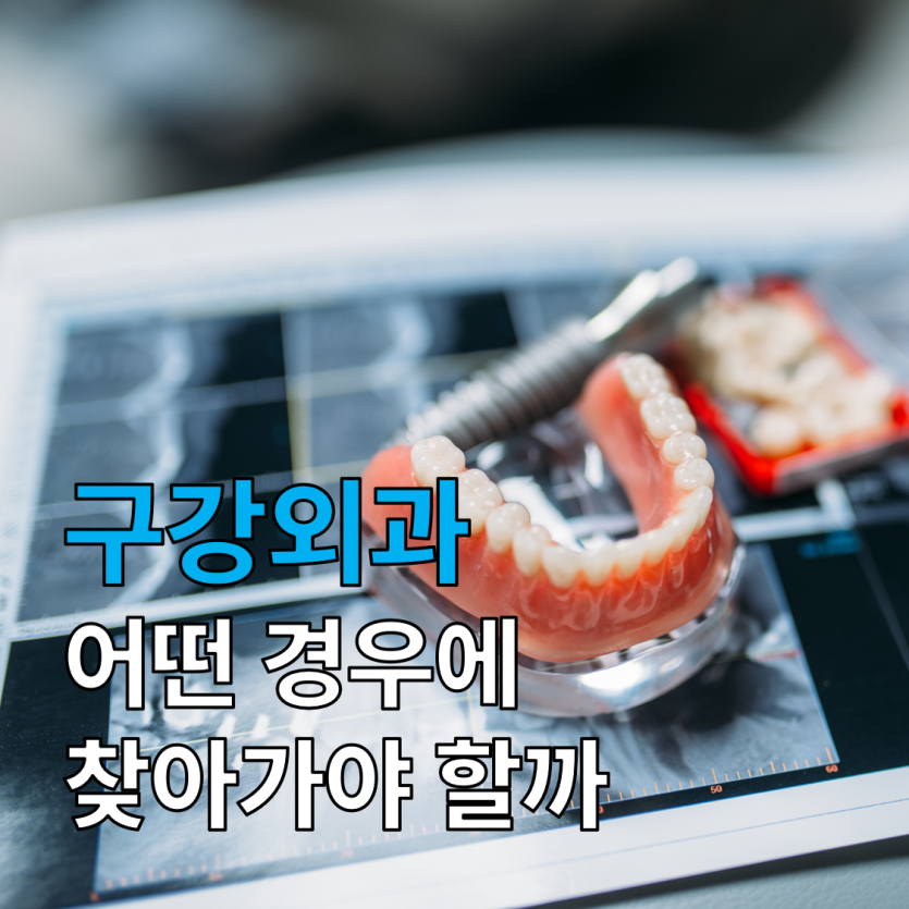 d8287a9dad54920a765d4c9dd66505f5_1785824654_2124.png