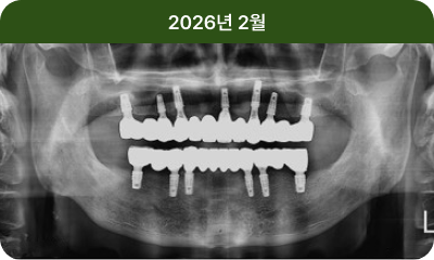 2026년 2월 유지 X-ray
