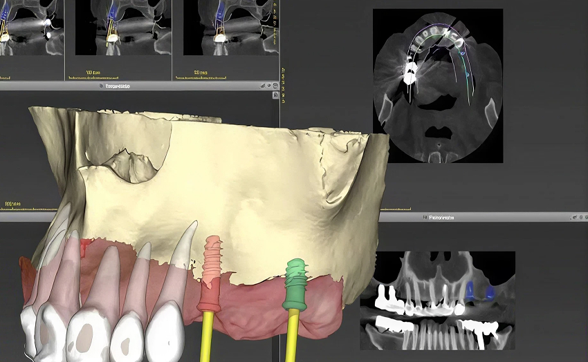 3D 구강스캐너